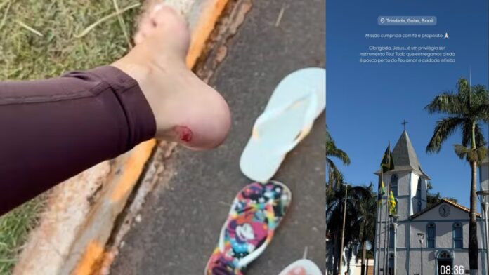 Gabriela Versiani mostra ferimentos após completar caminhada religiosa: ’18 km’